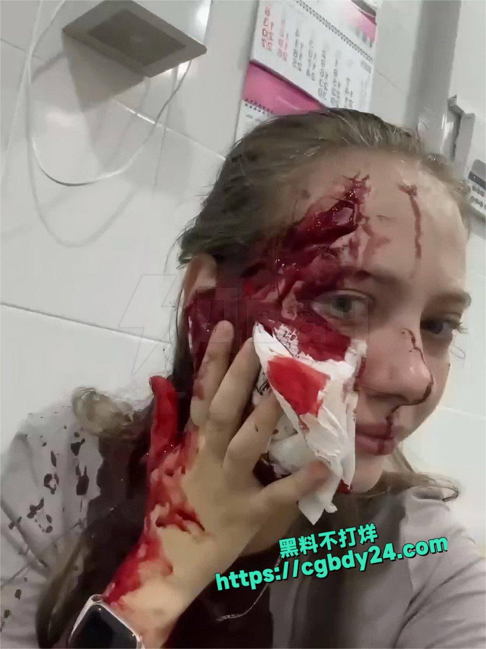 俄罗斯一名21岁女子