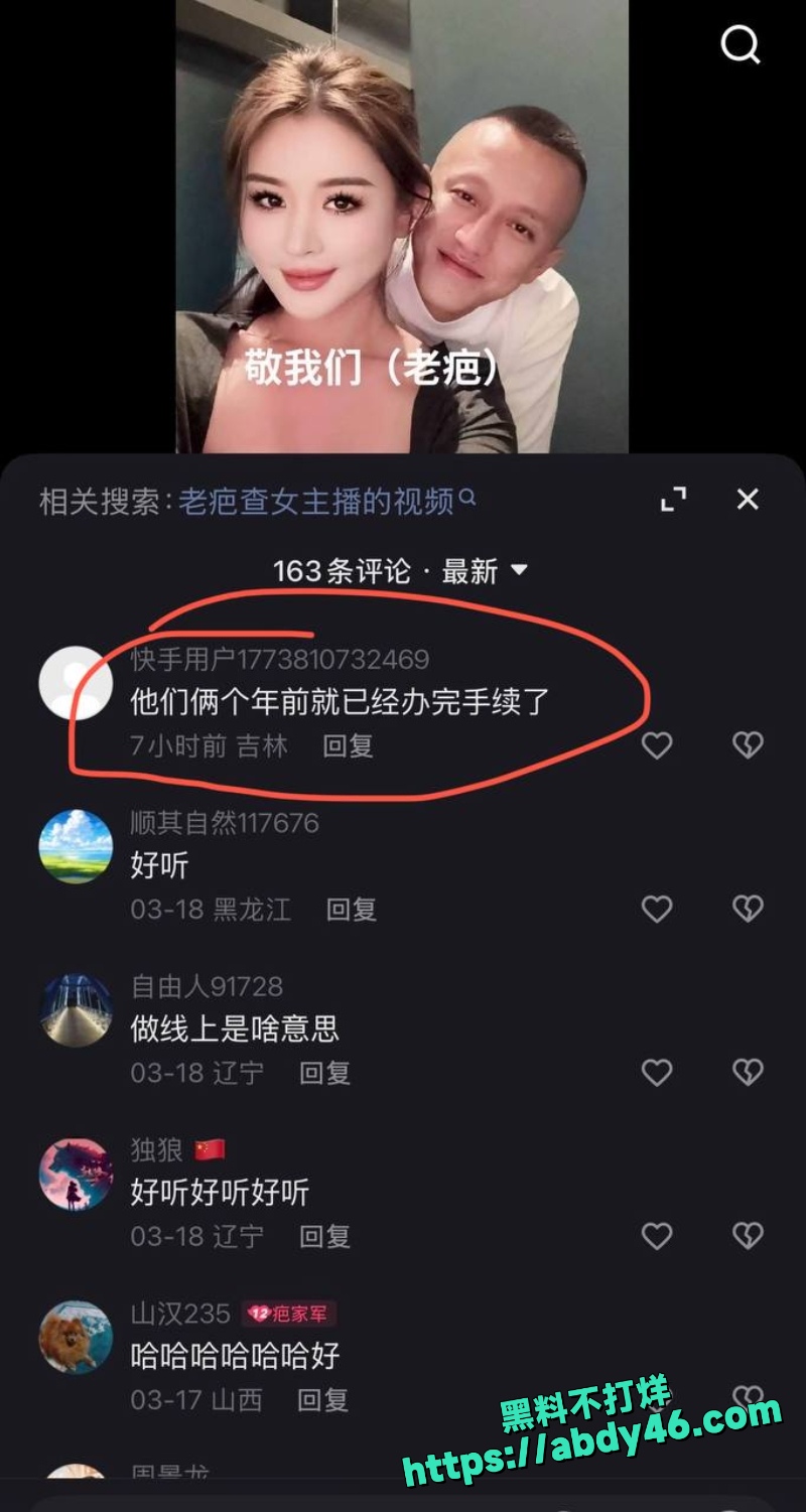 老疤 33