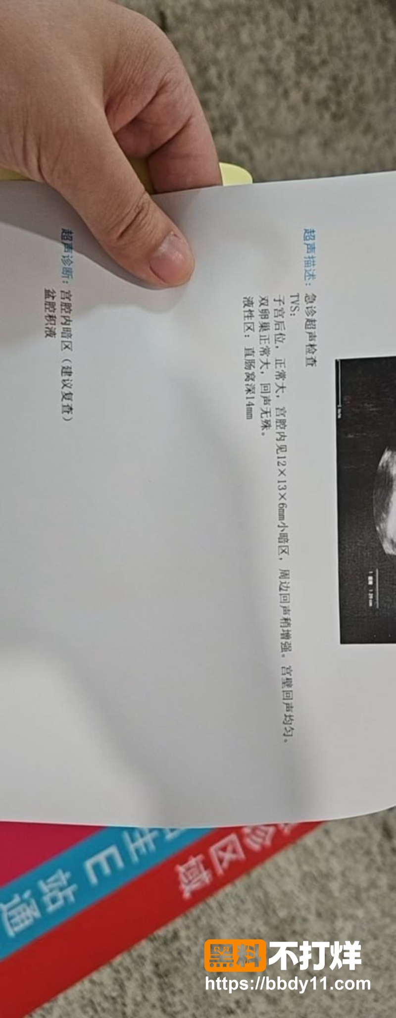 露脸微胖白皙眼镜人妻45