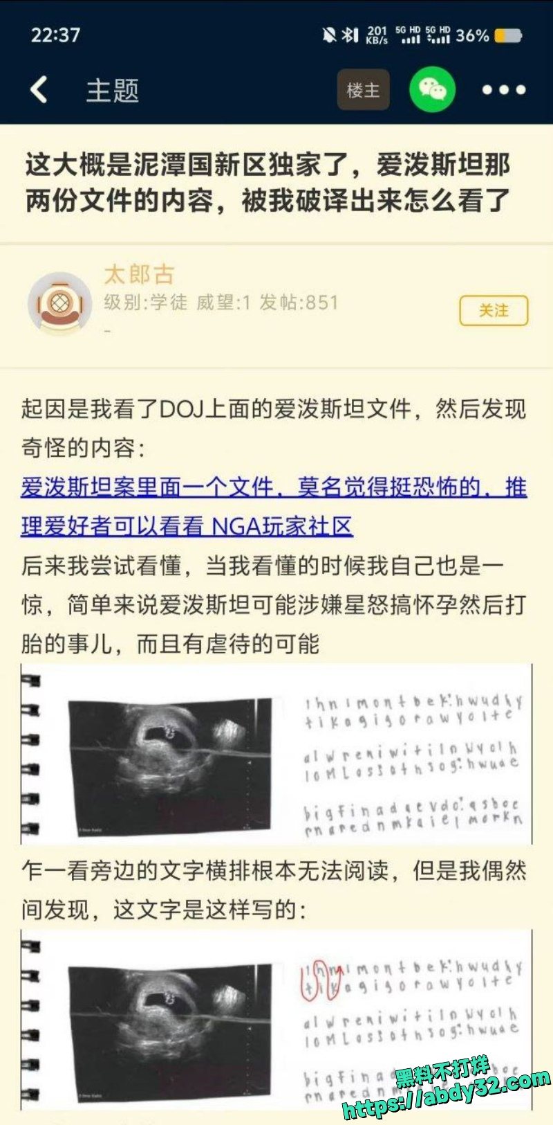 爱泼斯坦自缢后照片首公开 21