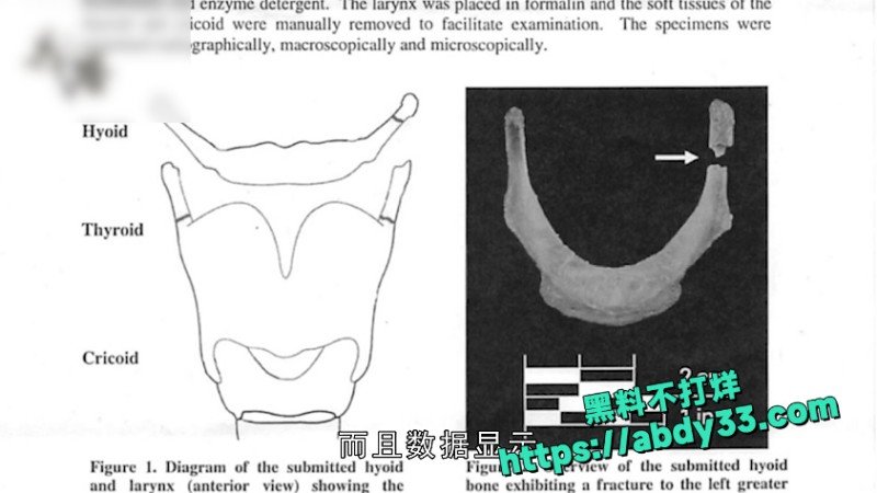 爱泼斯坦死亡谜团解开 4