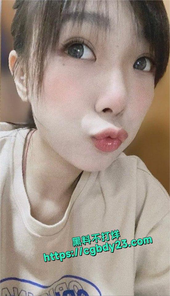 美牙师张晓晴14