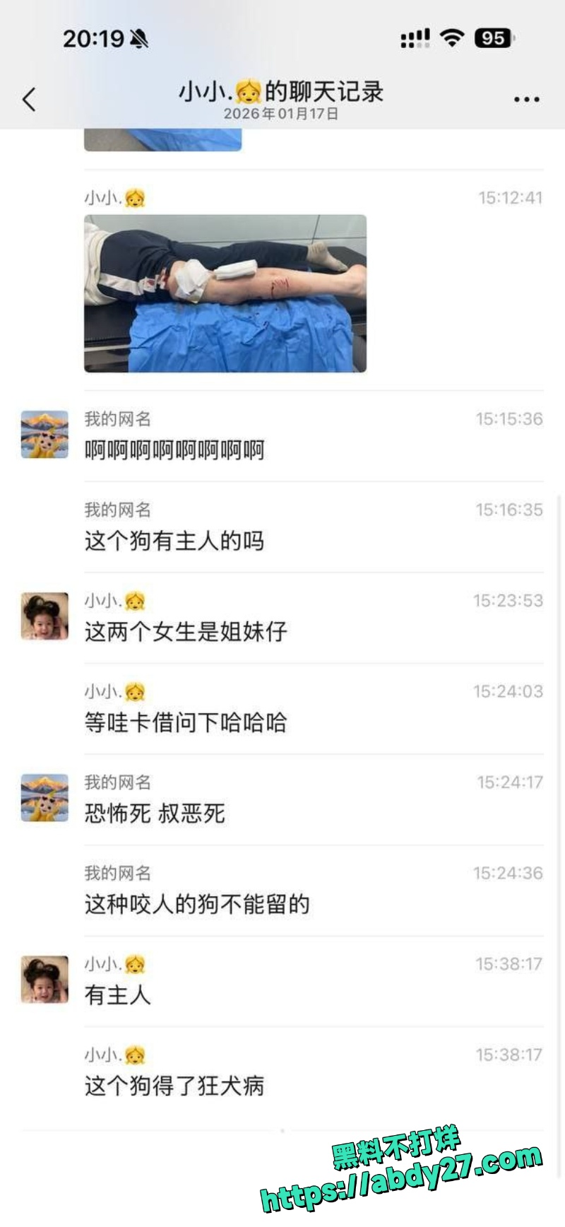 路过姐妹被疯狗追咬事件6