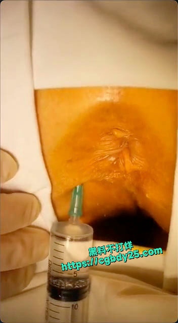 女子为了把第一次留给未来老公选择长期肛交把屁眼玩坏了3