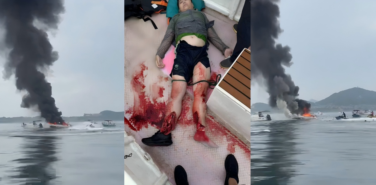 威海码头休闲船突起大火 有人跳海重伤身亡 小孩胳膊断裂 太揪心