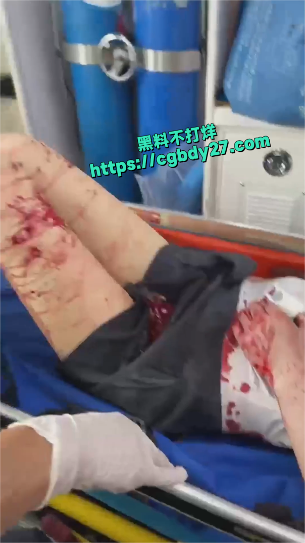 男子持刀砍伤妻子4