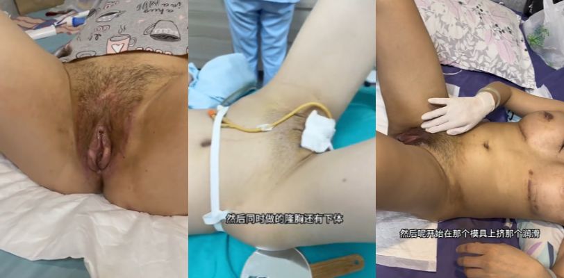男变女人造阴道肥美诱人 奶子同步升级圆润弹手 手术后润滑自慰真实记录