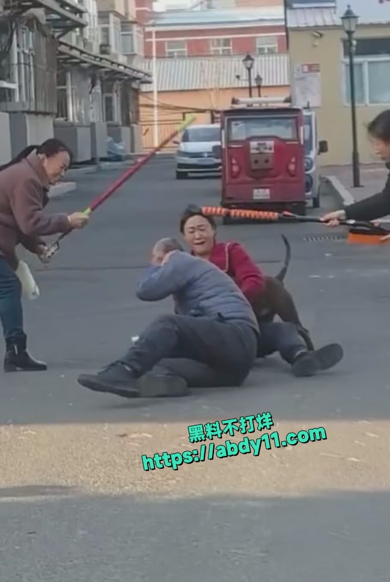 大爷被街头恶狗拼命撕咬不松口 7