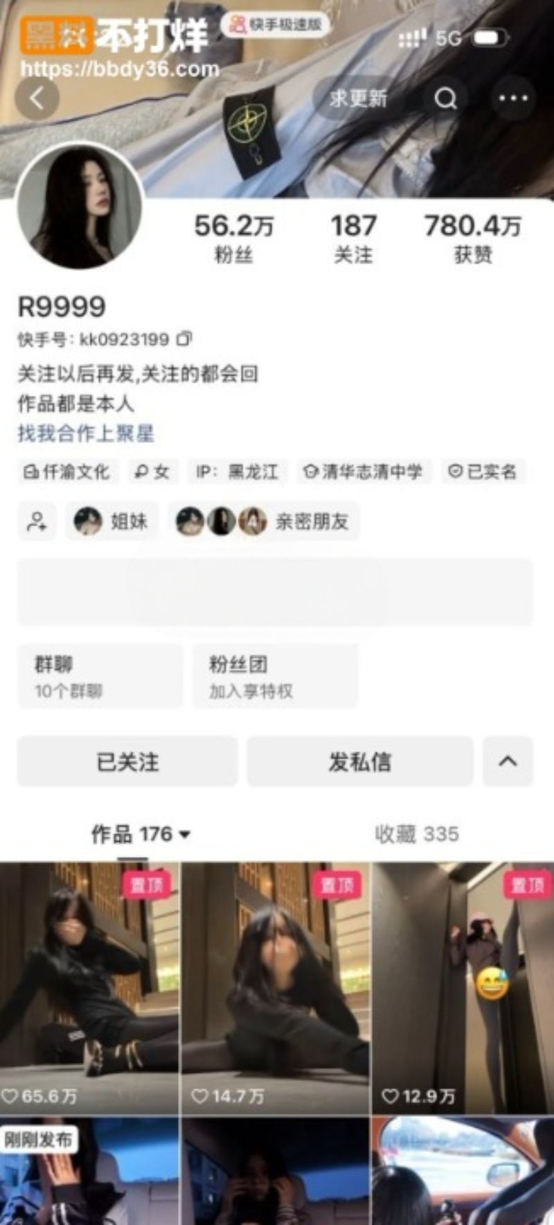 wann晚高颜值私密视频泄露7cleanupW800px