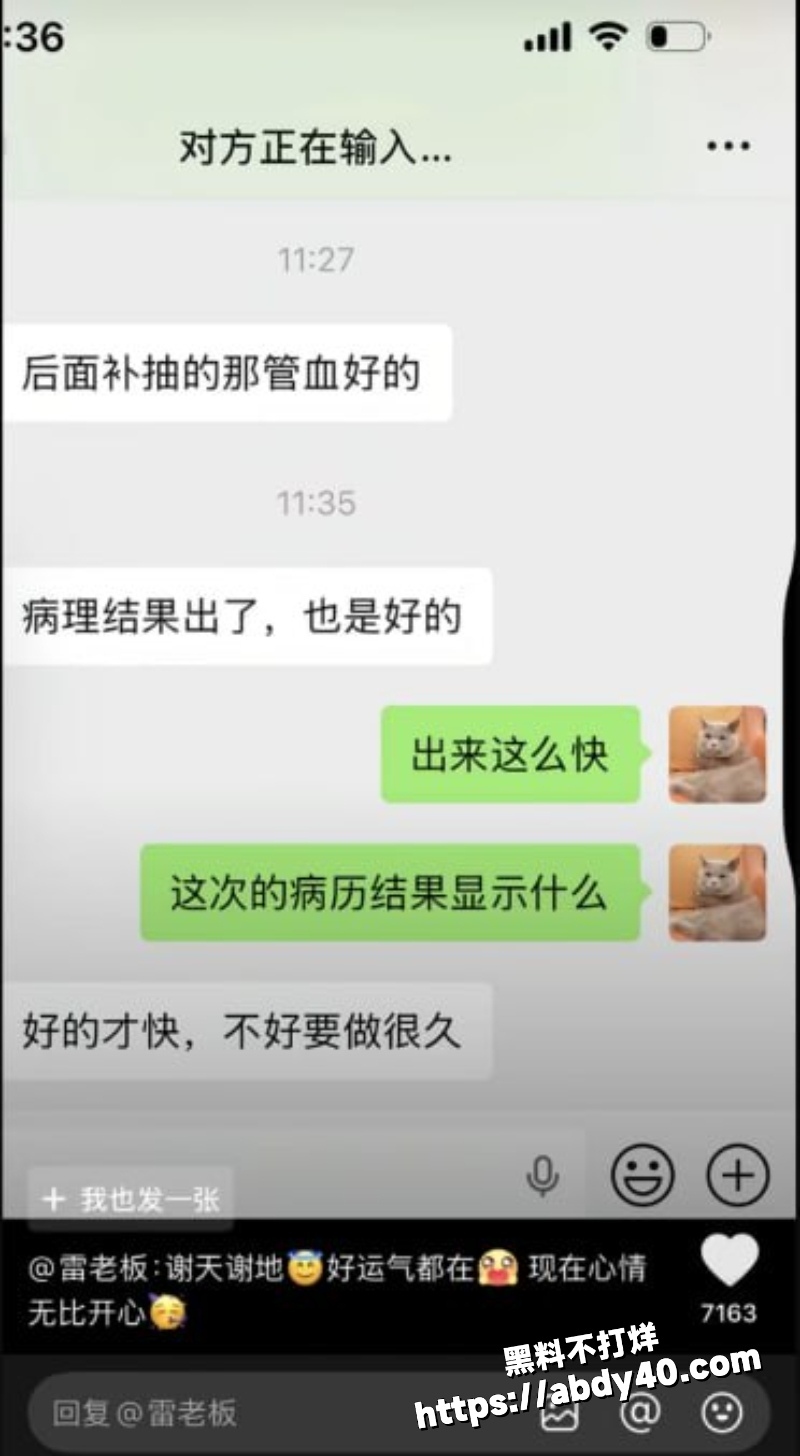 抖音百万粉丝网红安静公主直播自曝肛裂17