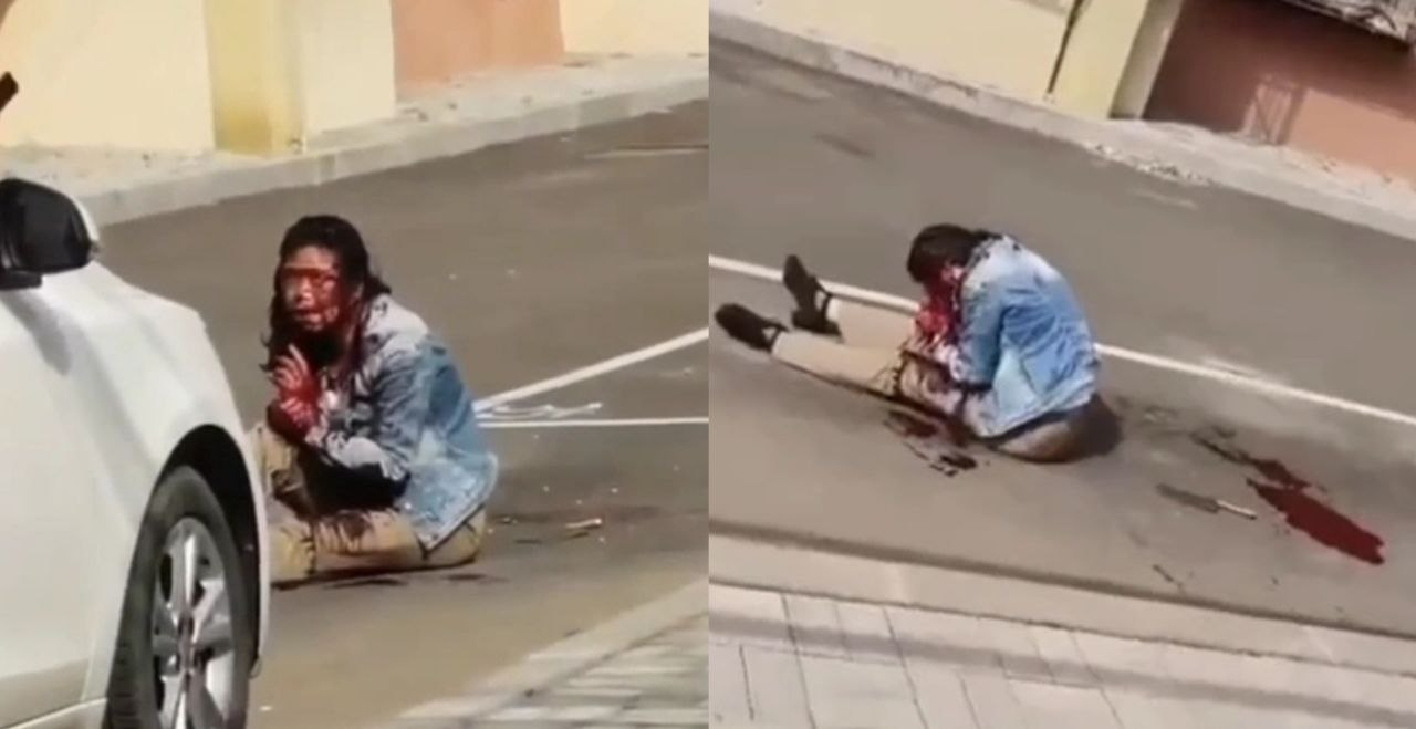 沈阳铁西区启工街桥园小区 女子被砍满头是血 胆小的人看完得做噩梦啊
