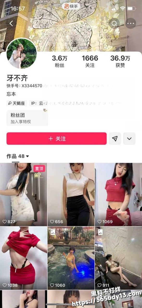 牙不齐3