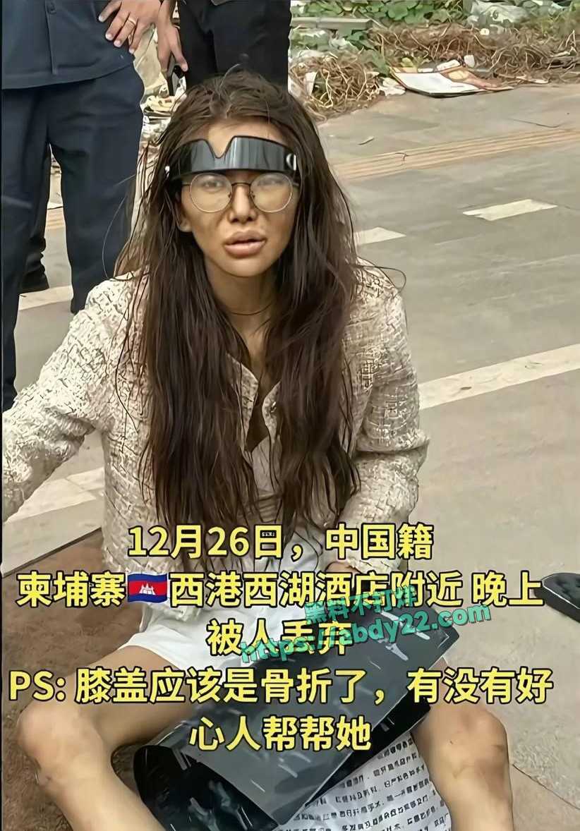 umi沦落街头成疯癫大妈 6