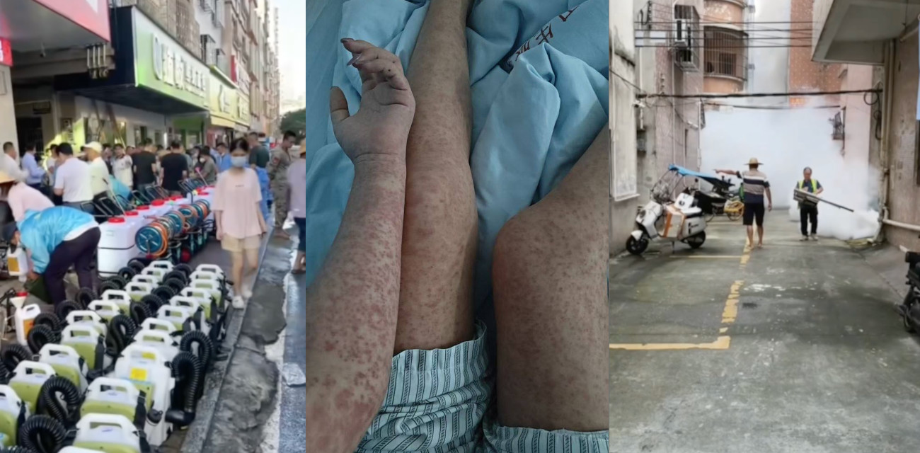 广州基孔肯雅热疫情肆虐 蚊子恐为传播源 零号患者惊现