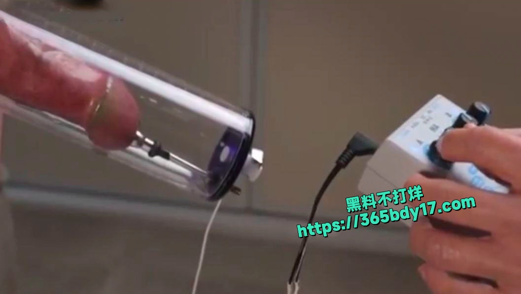 国外拔火罐式马眼棒刺取精法 4