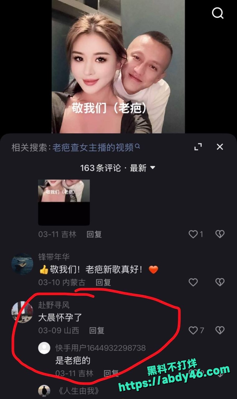 老疤 34