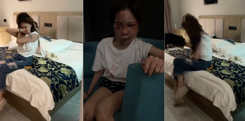 谭竹匆忙逃离重庆 网落流传被外网悬赏200W取谭竹人头 谭竹被打成猪头视频照片 真假自辨！