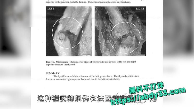 爱泼斯坦死亡谜团解开 3