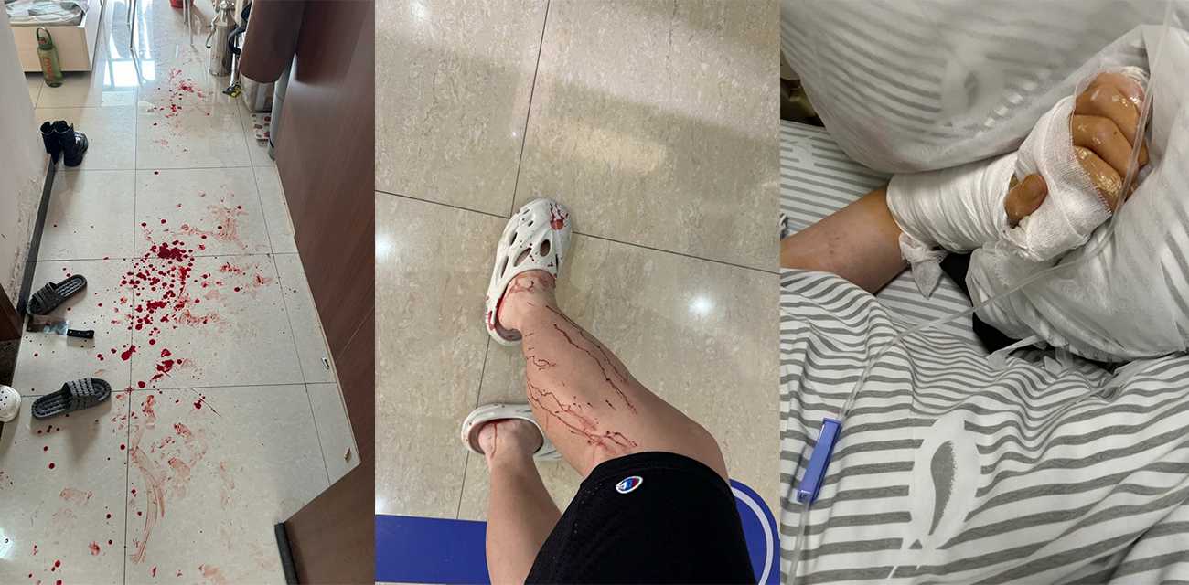 逆天！B站up主被女友家暴狂砍十几刀 小仙女母亲带人上门称不谅解就告男方强奸