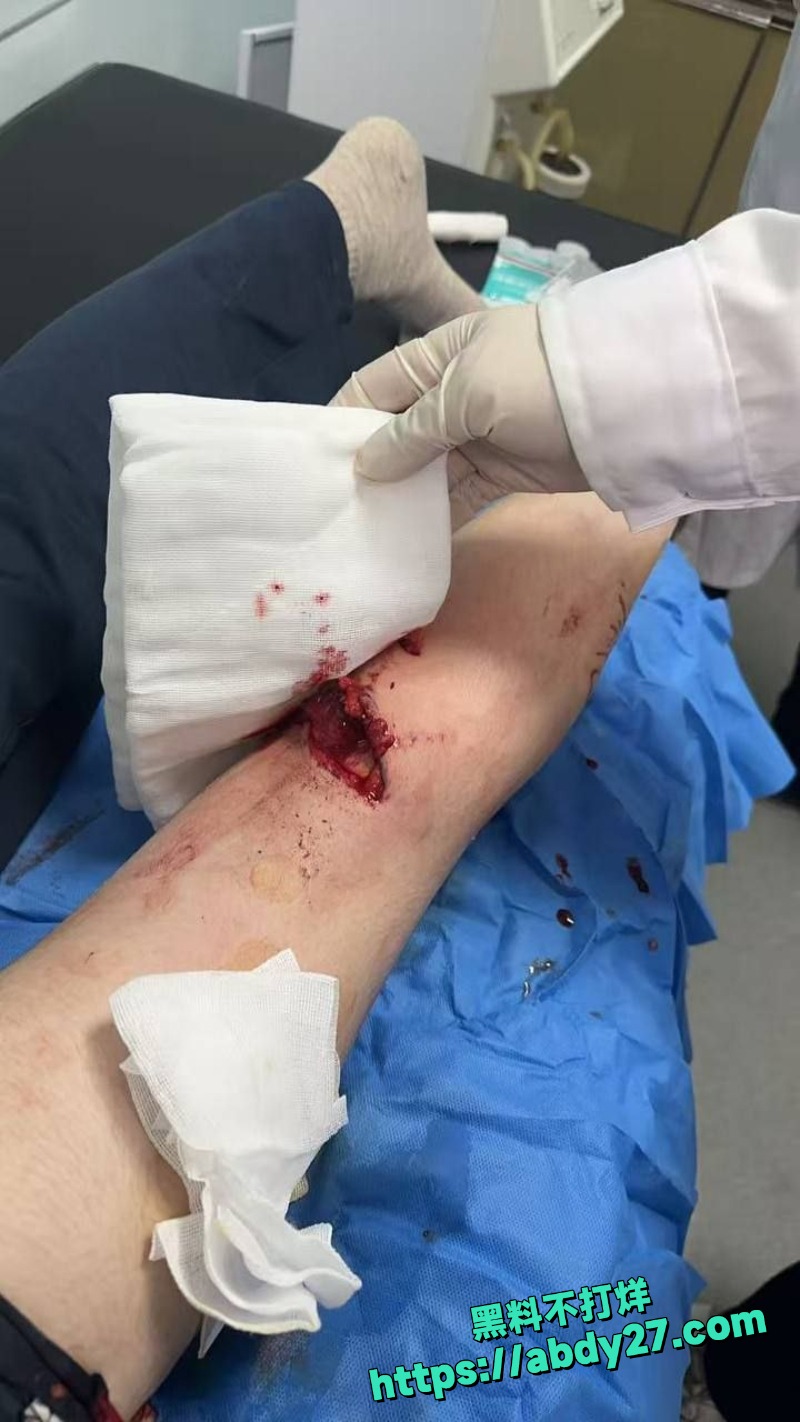路过姐妹被疯狗追咬事件2