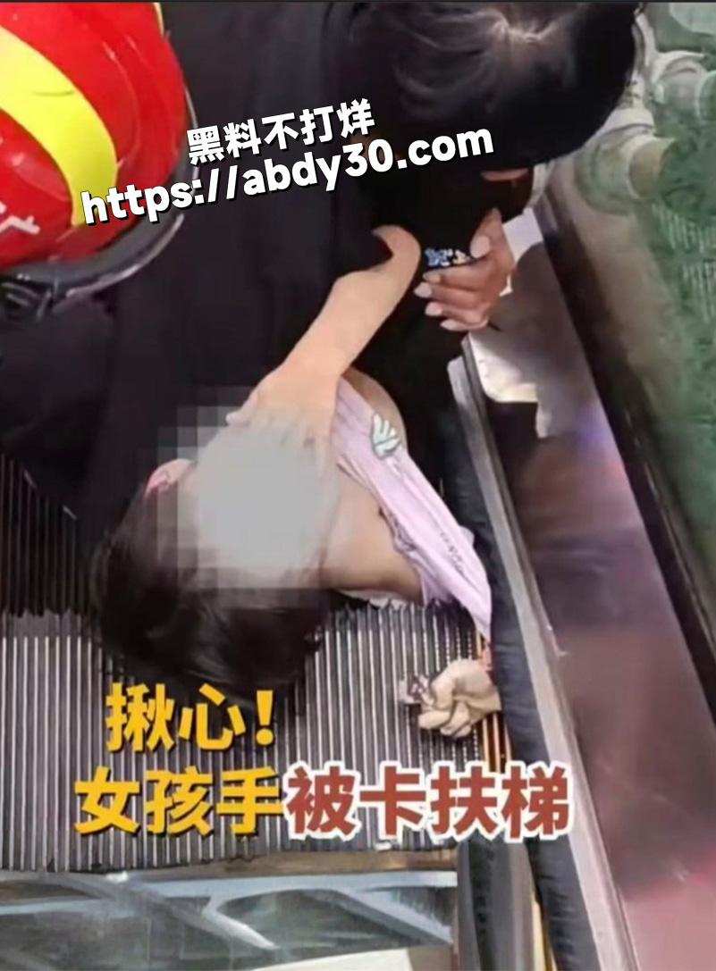 小女孩乘扶梯手被夹手1