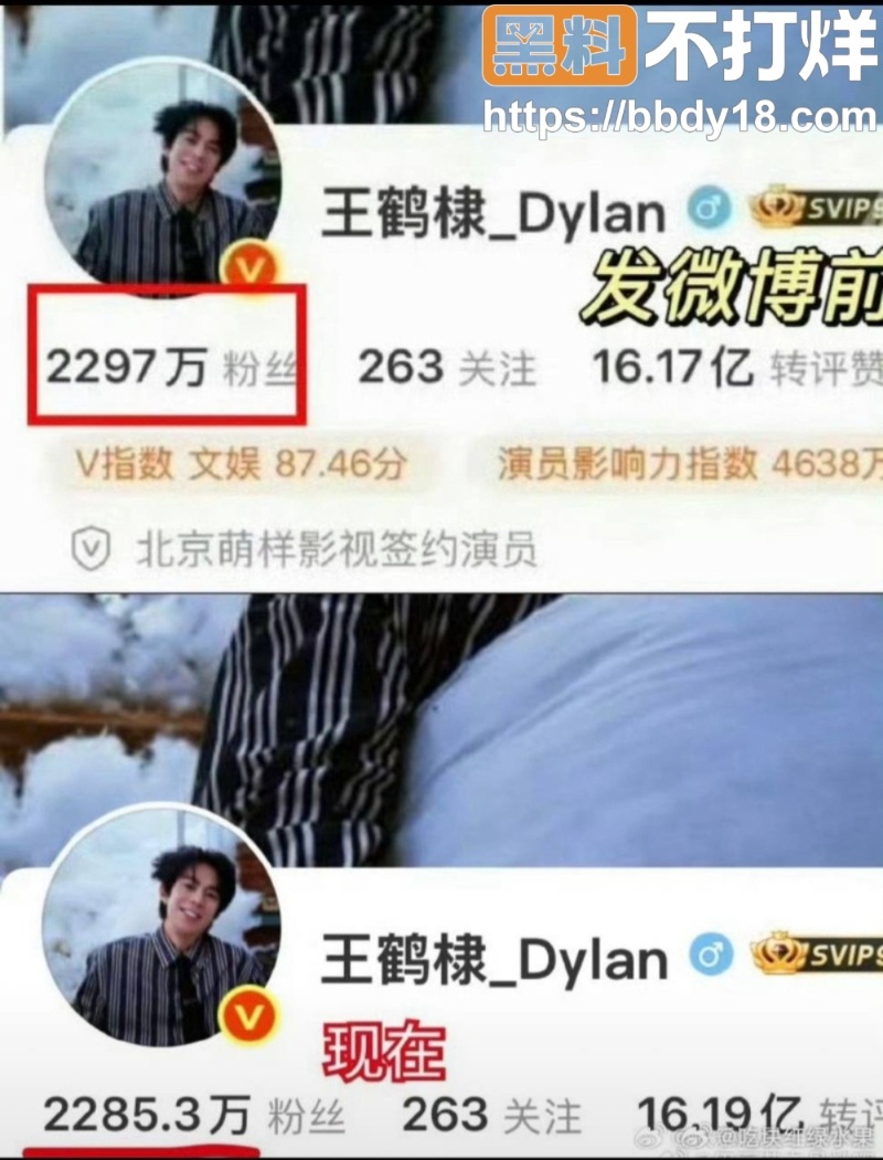 王鹤棣2cm精神小伙2
