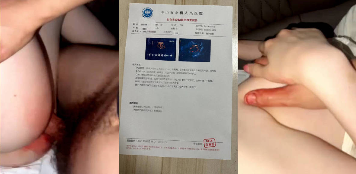 玛德BBQ了！闯了个“红灯”结果女友黄体破裂！怎么办？小榄人民医院你是认真的么？
