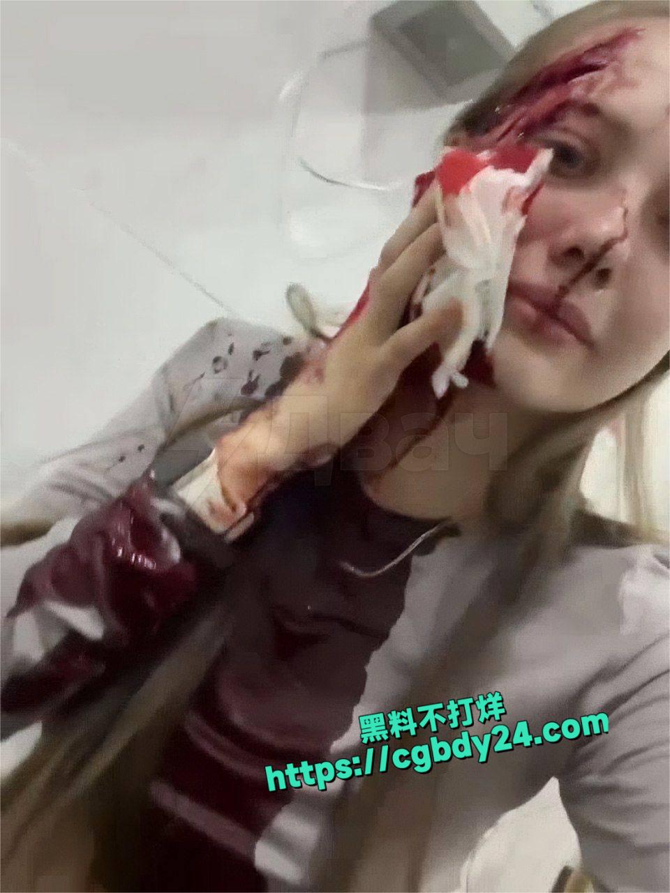 俄罗斯一名21岁女子1