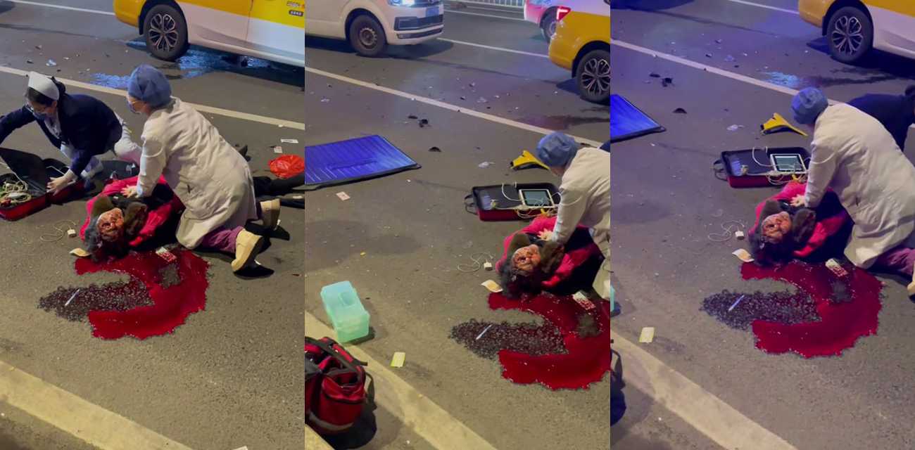 福州闽侯南屿老太太马路被撞爆浆 现场血流成河医护抢救血流不止 太吓人了