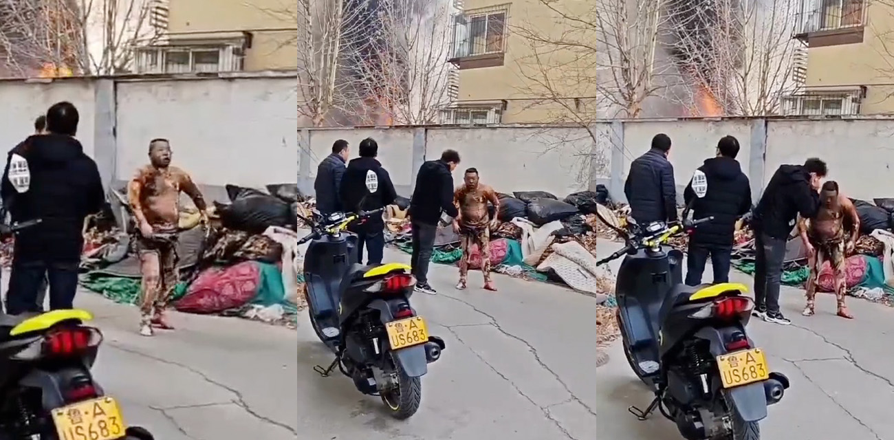 山东一小区发生火灾 一男子严重烧伤逃出形似丧尸 不要玩火自焚！