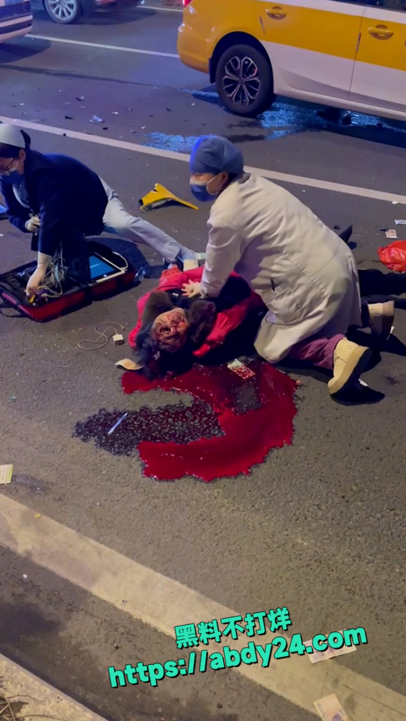 福州闽侯南屿老太太马路被撞 爆浆 3
