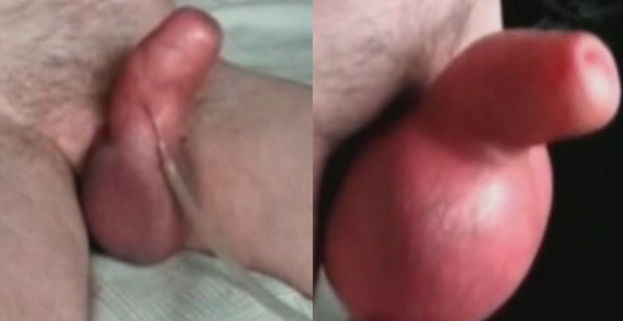 妈妈再也不用担心我鸡鸡小了 用充气机给鸡巴充气 得到女人见到就流泪的大鸡巴