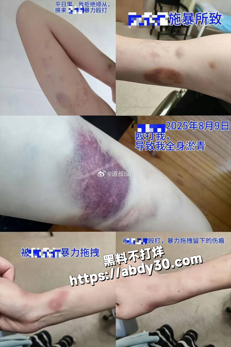 莆田涵江塘头学校领导违背妇女意愿12