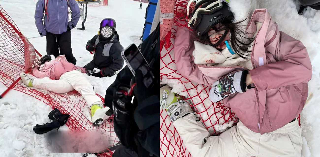 传遍全网的滑雪场碰撞事故 姑娘的脚都折到头上来了 现场画面惨不忍睹