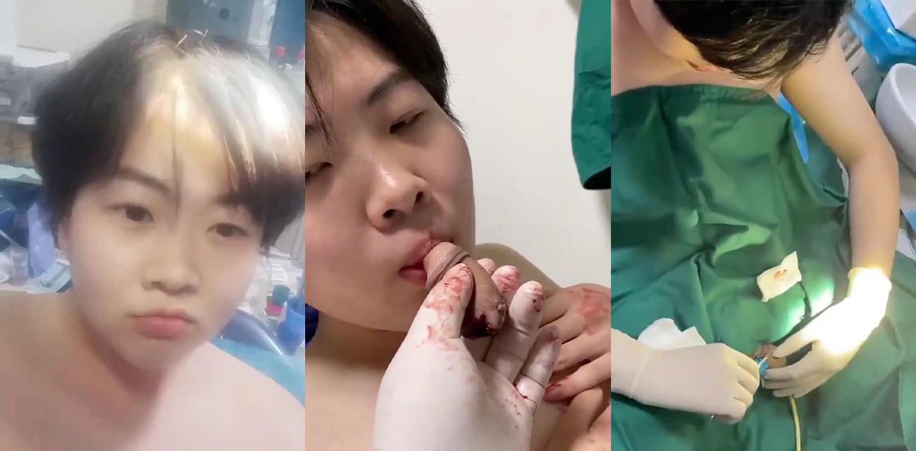 男子为了自己给自己口交 竟然切下自己的鸡巴放嘴里吮吸 胆小勿看！