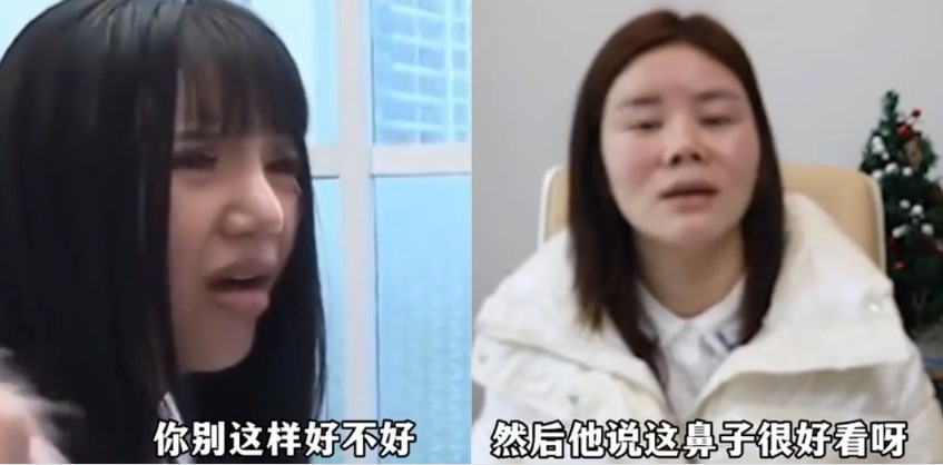 笑不活了 整容失败合集 本来是个忧伤故事 可是实在忍不住笑 善哉