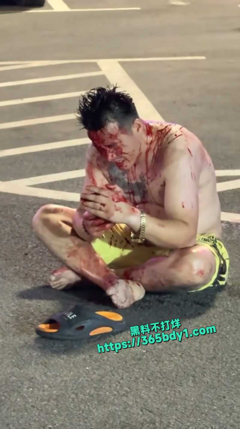 几名男的酒后发生口角互殴2