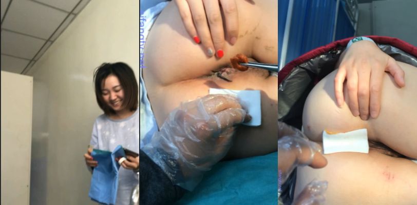 【医院泄密】内部教学给女痔疮患者换药过程！