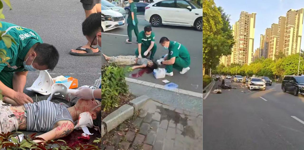 女骑士未戴头盔惨遭车祸七窍流血 命悬一线引发热议 摩托车安全再敲警钟