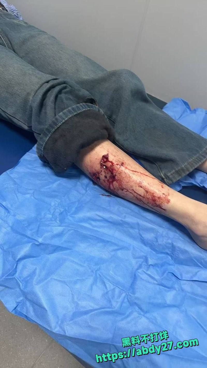 路过姐妹被疯狗追咬事件5