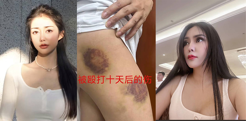 云南省丽江巿宁蒗县原公安局长刘云超隐婚骗炮33岁单身女2次堕胎 裸照威胁孕期殴打入院