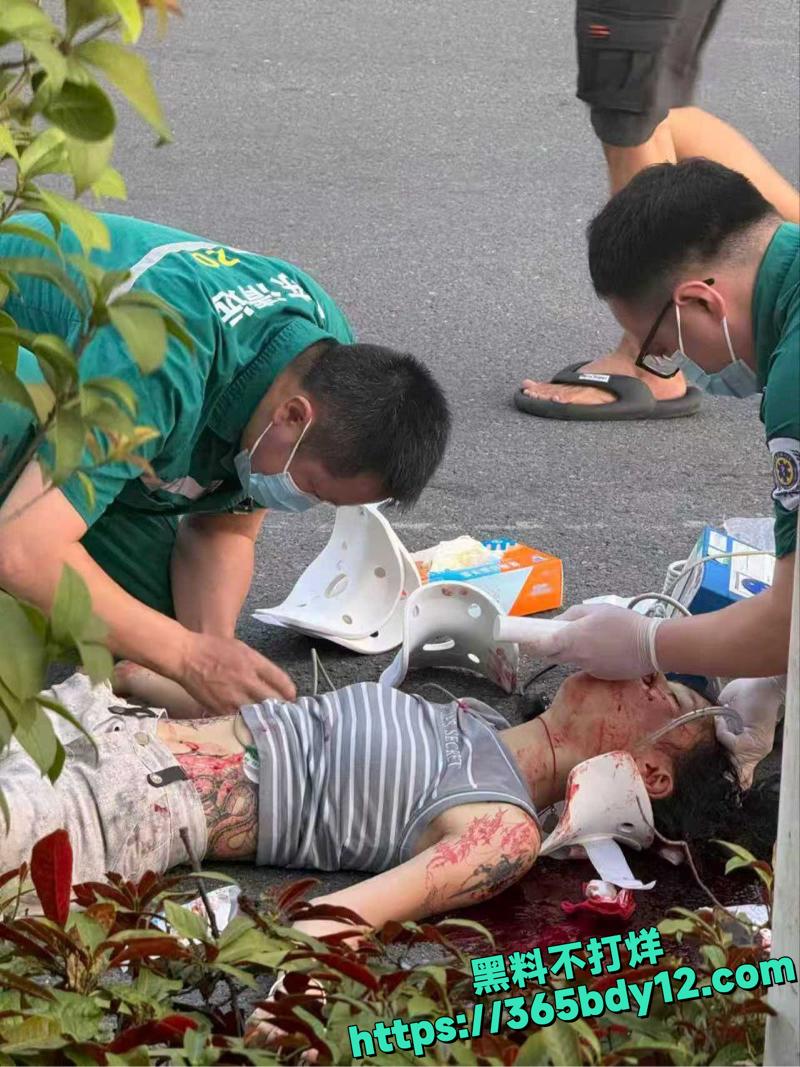女骑士未戴头盔惨遭车祸七窍流血1.