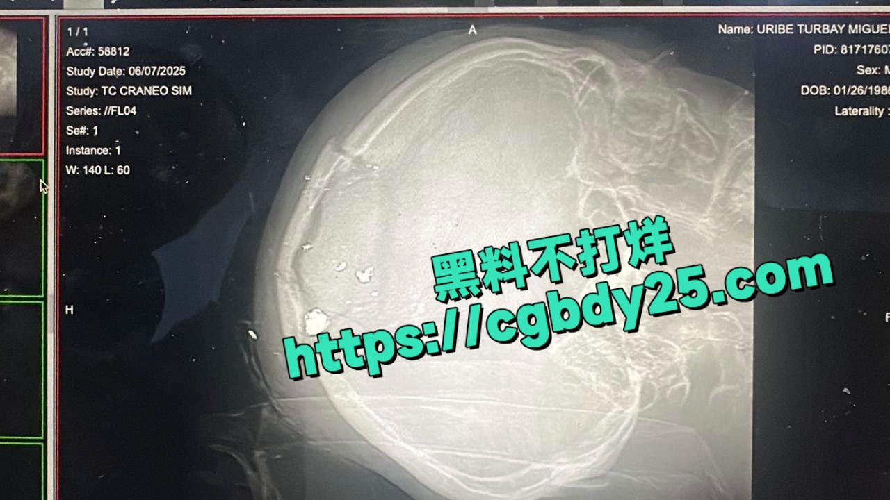 哥伦比亚总统候选人遭枪击1