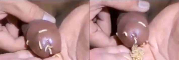 马眼里面都是蛆，打手虫真的打出来了虫 蛆