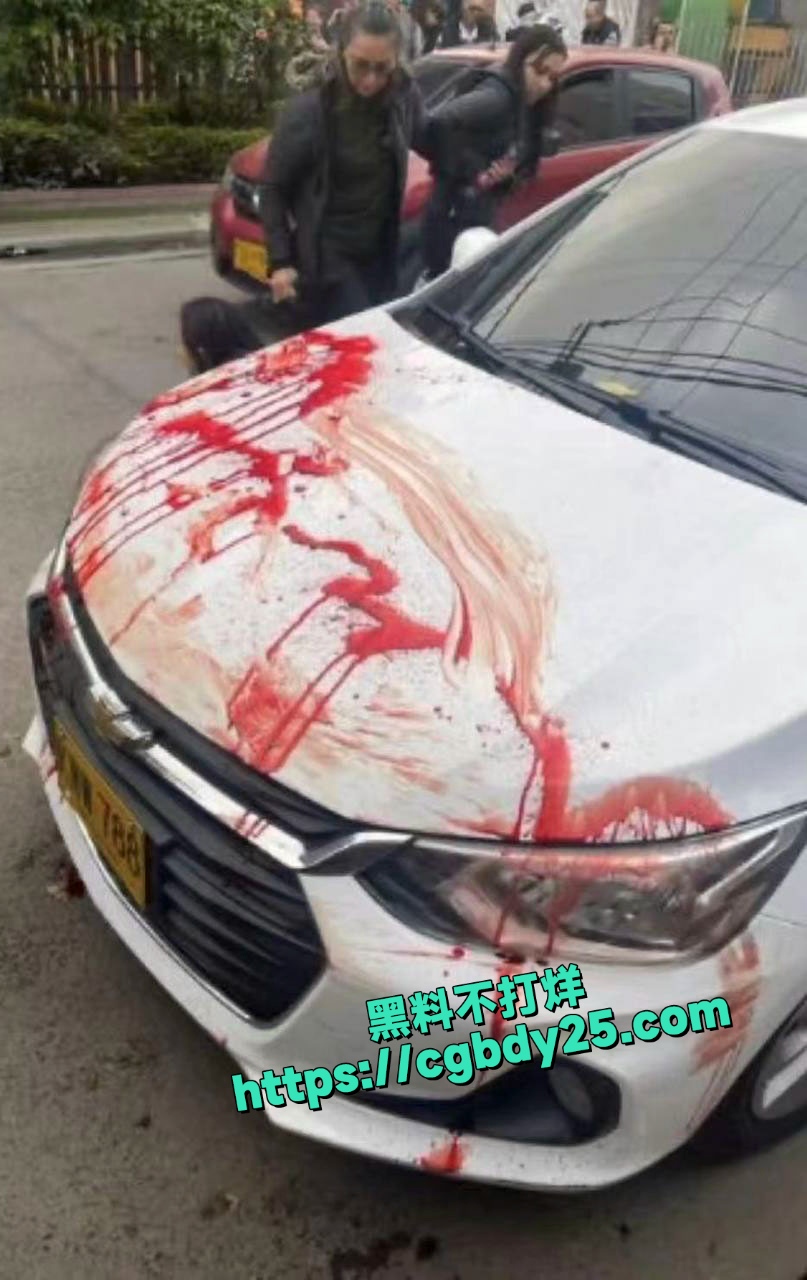 哥伦比亚总统候选人遭枪击7