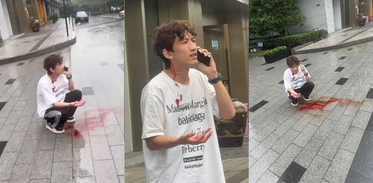 杭州男模江江自称网络乞丐 讹上谁就不放过不断纠缠 最终被人怒而暴打开瓢