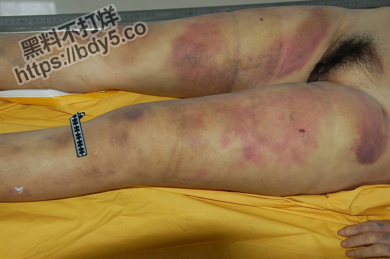 胆小慎入绝密档案之医院太平间.jpg