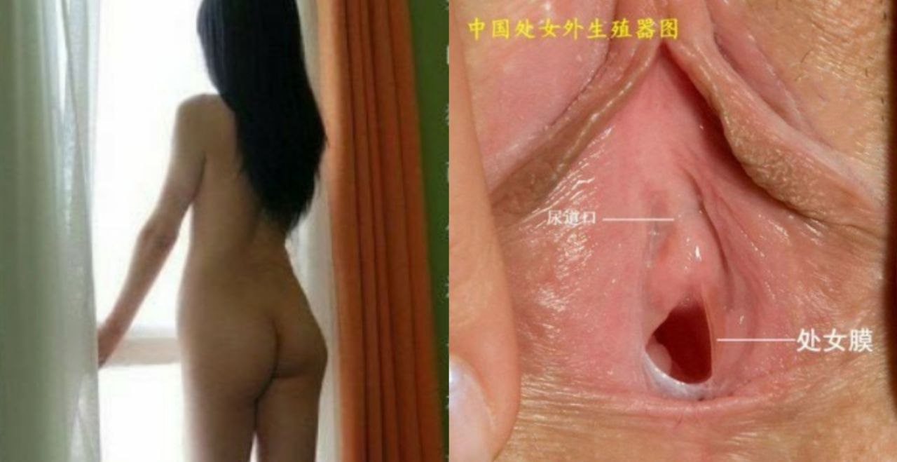 如何分辨纯天然处女和后期人工手术修复的处女膜 给狼友们科普下小知识