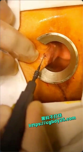 女子为了把第一次留给未来老公选择长期肛交把屁眼玩坏了5