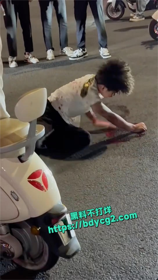 临沂罗庄精神小伙斗殴现场下手没轻没重差点出人命5